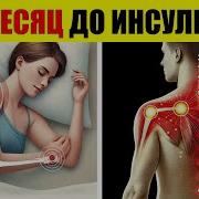 7 Тихих Признаков За 1 Месяц До Инсульта