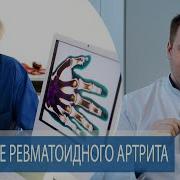 Как Лечить И Лечение Ревматоидного Артрита