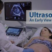 Ultra Sound