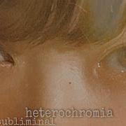 Саблиминал Гетерохромия