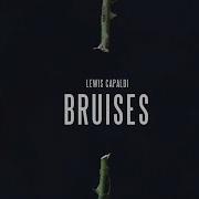 Lewis Capaldi Bruises Official Audio