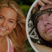 Castaway Burns Hand On Camp Fire Australian Survivor