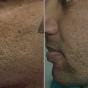 Curio Sabs Facial Scars Healing