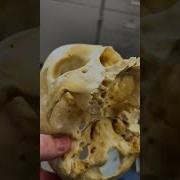 Human Skull