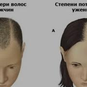 Сабаби Рехтани Муйи Сар
