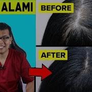 Rambut Uban Kembali Hitam Seketika Cara Cepat Menghitamkan Uban Hasil