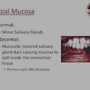 Oral Lesions Bioresonance