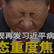 央视再发习近平病态 步履蹒跚 反应迟钝 神态重度焦虑